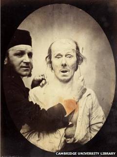 Benjamin Duchenne and man with electrodes on his facial muscles